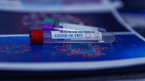 EU wil praten over vrijgeven patenten coronavaccins